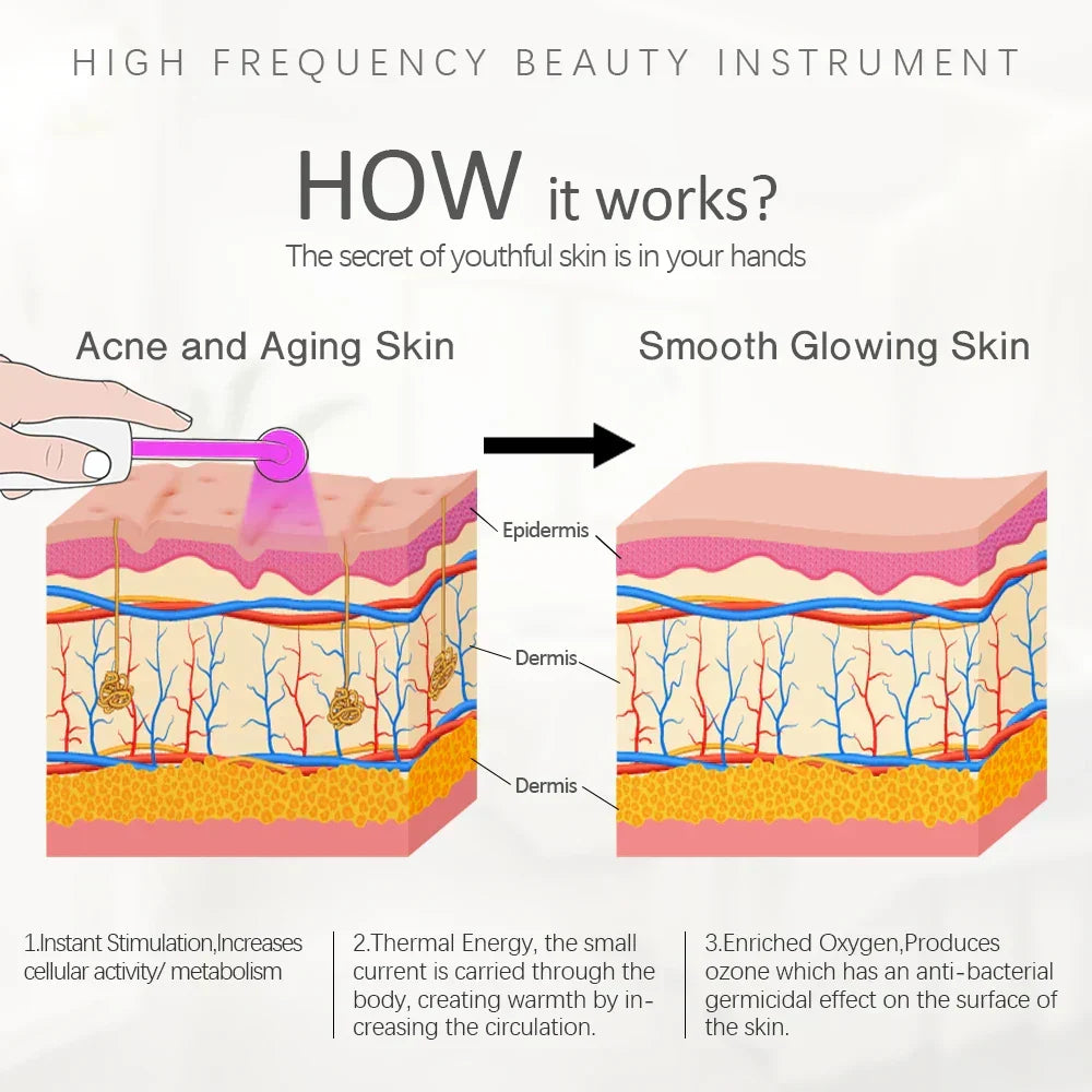 High-frequency beauty instrument illustration with skin cross-section and glow result
