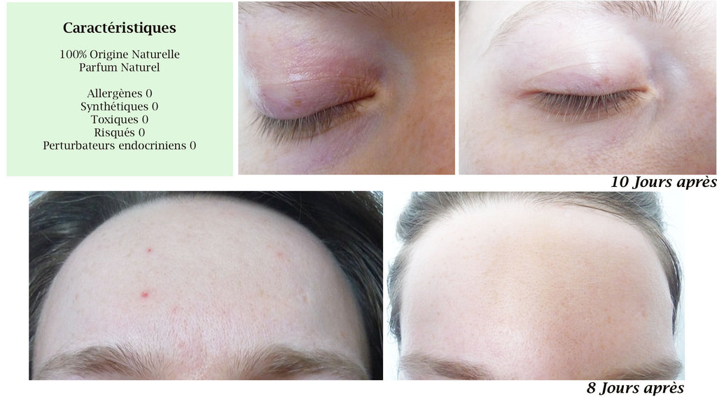 PRO - MERVEILLE DES LANDES ORGANIC - Sensitive Skin Care Complete Regeneration-11