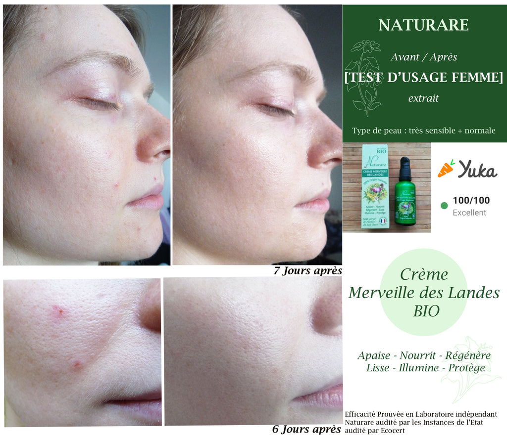 PRO - MERVEILLE DES LANDES ORGANIC - Sensitive Skin Care Complete Regeneration-10